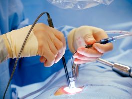 Revascularisation Laser Transmyocardique