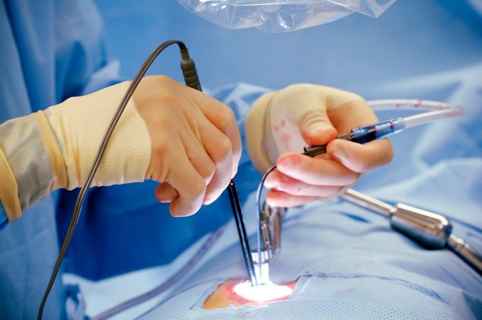 Revascularisation Laser Transmyocardique