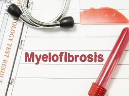 Myelofibrozis