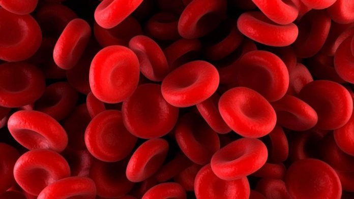 ¿Qué es la anemia?