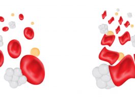 ¿Qué es la anemia mediterránea?